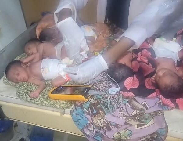 SAD : Kano woman d!es hours after delivering quintuplets