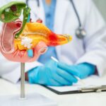 New drugs raise hopes of pancreatic cancer breakthrough