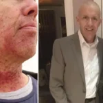 Man had dormant STI from oral s3x for 30 years before it became life-threatening