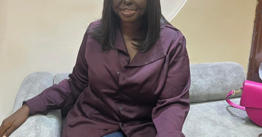A prayerful man who doesn’t cheat and lie – Nigerian acid attack survivor reveals what she wants in a partner