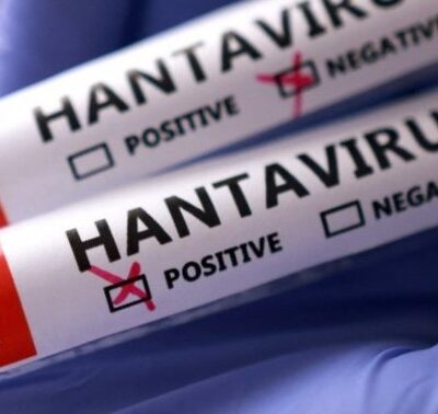 BREAKING : Hantavirus classified as ‘Level 3’ outbreak