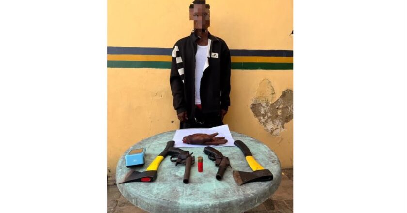 Man caught with severed human hand around Lekki-Epe Expressway in Lagos