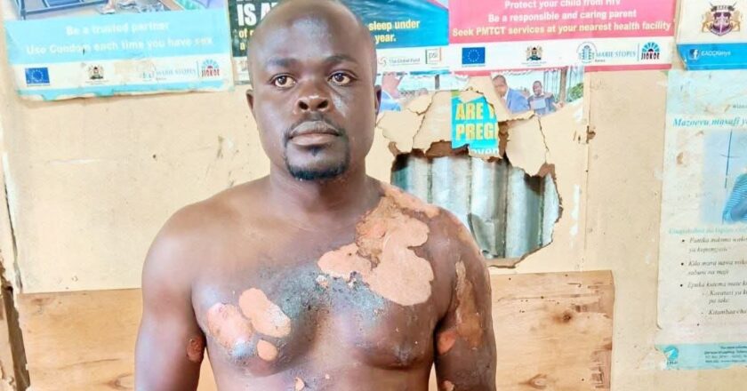 Kenyan woman attacks her husband with boiling water after he introduced his second wife
