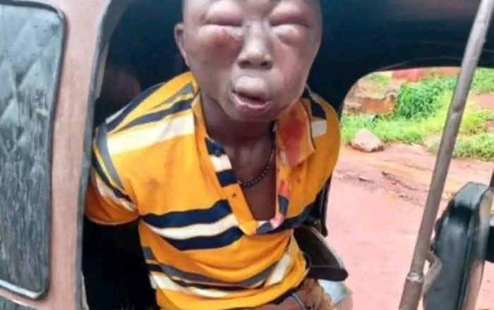 Man beaten to pulp after being accused of stealing money in Anambra