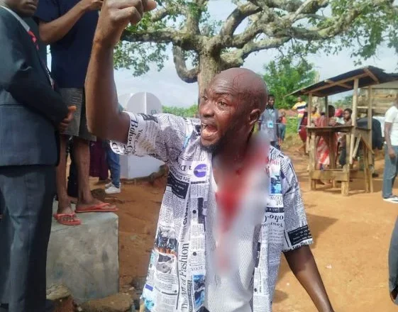 One Person Injured as APC and ADC Supporters Clash Over Alleged Vote-Buying During Ongoing Ekiti 2026 Election