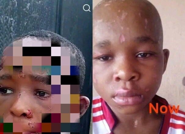 New photo of 10-year-old boy severely b@ttered by his guardian in Anambra