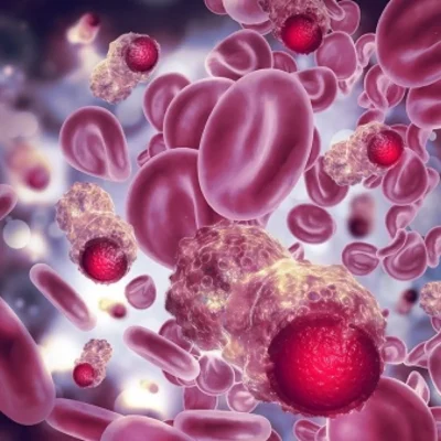 FG expands cancer patient support funds to check treatment costs